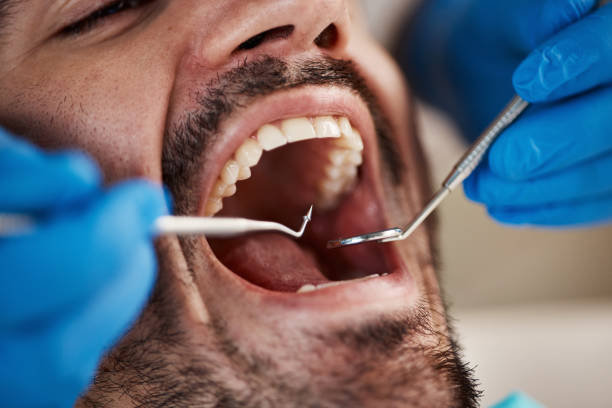 Best Walk-In Emergency Dentist in Williamsville, NY